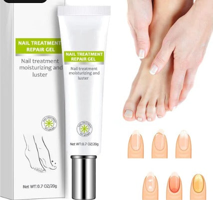 NAIL REPAIR GEL
